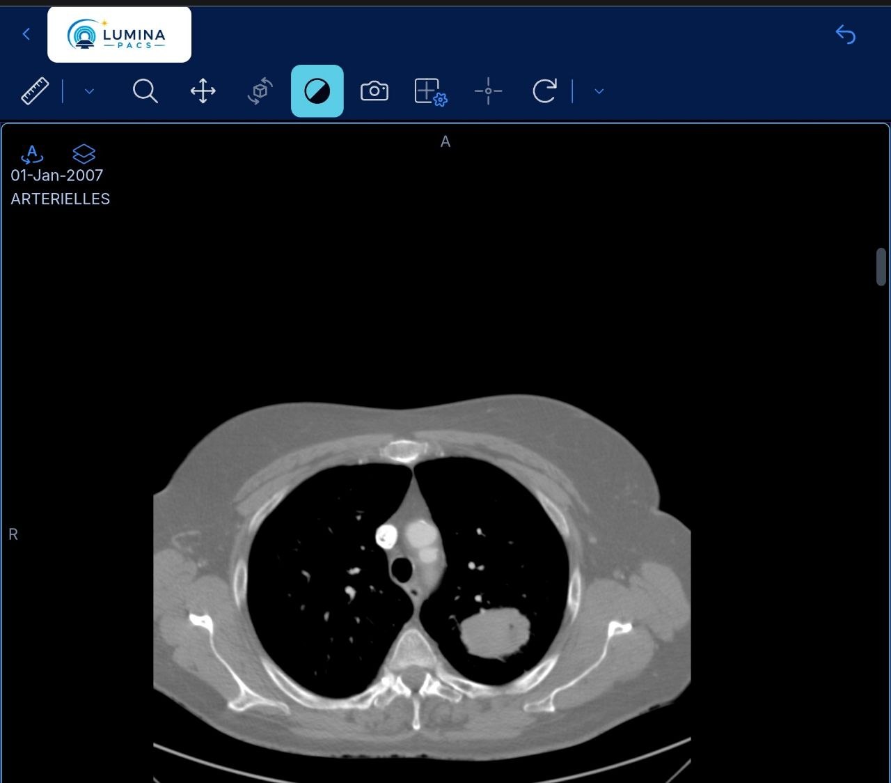 Lumina PACS diagnostic viewer